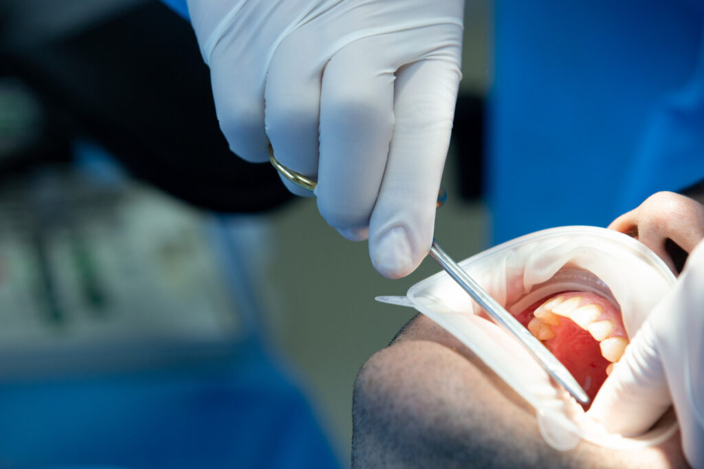 Patient receiving a dental implant procedure at West Brickell Dental in Miami.